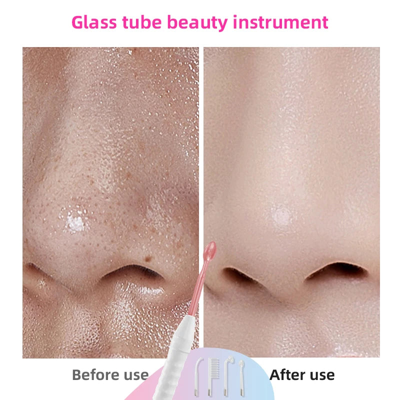 4in1 High frequency facial wand